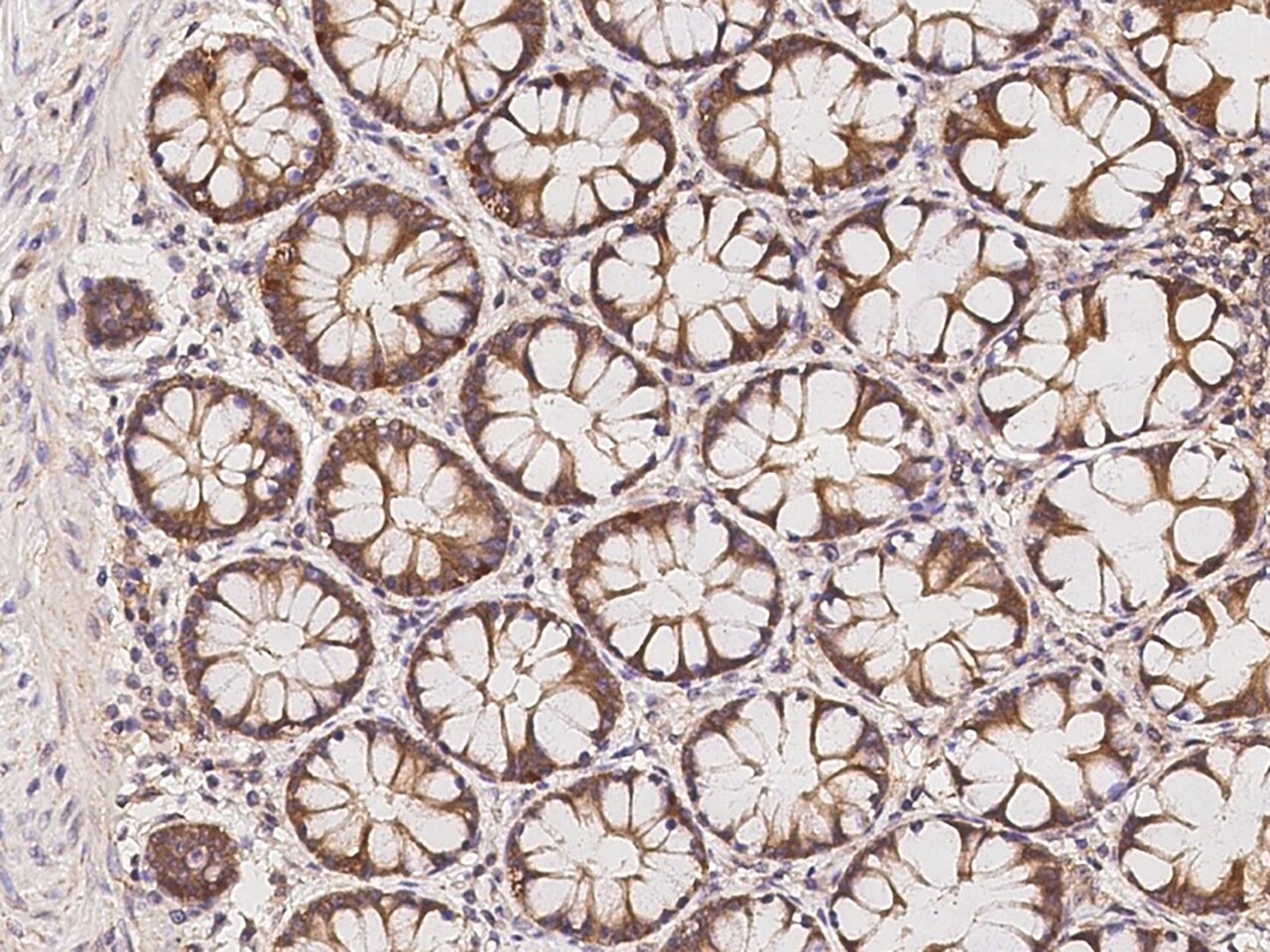 PHACTR4 Antibody - BSA Free