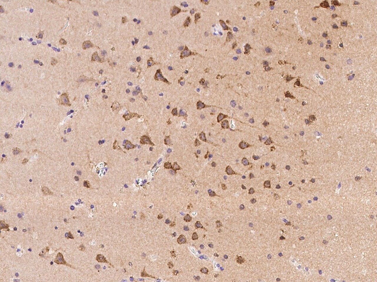 RNF180 Antibody - BSA Free
