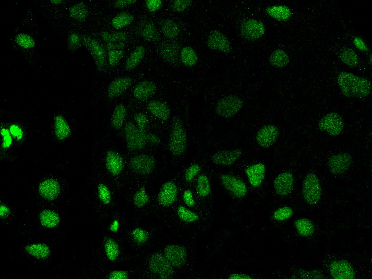 PROSER1 Antibody - BSA Free