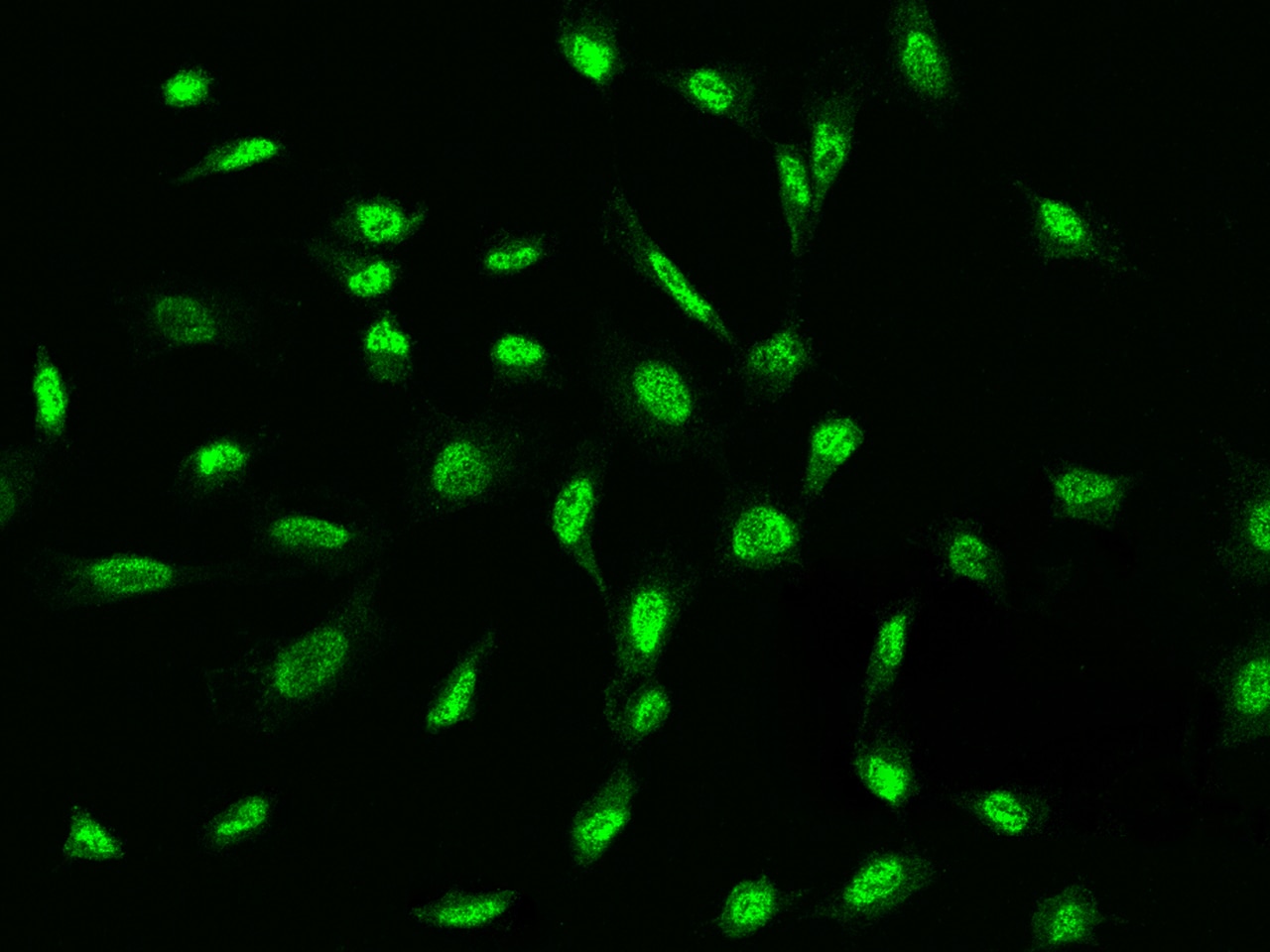 ADAMTSL4 Antibody - BSA Free