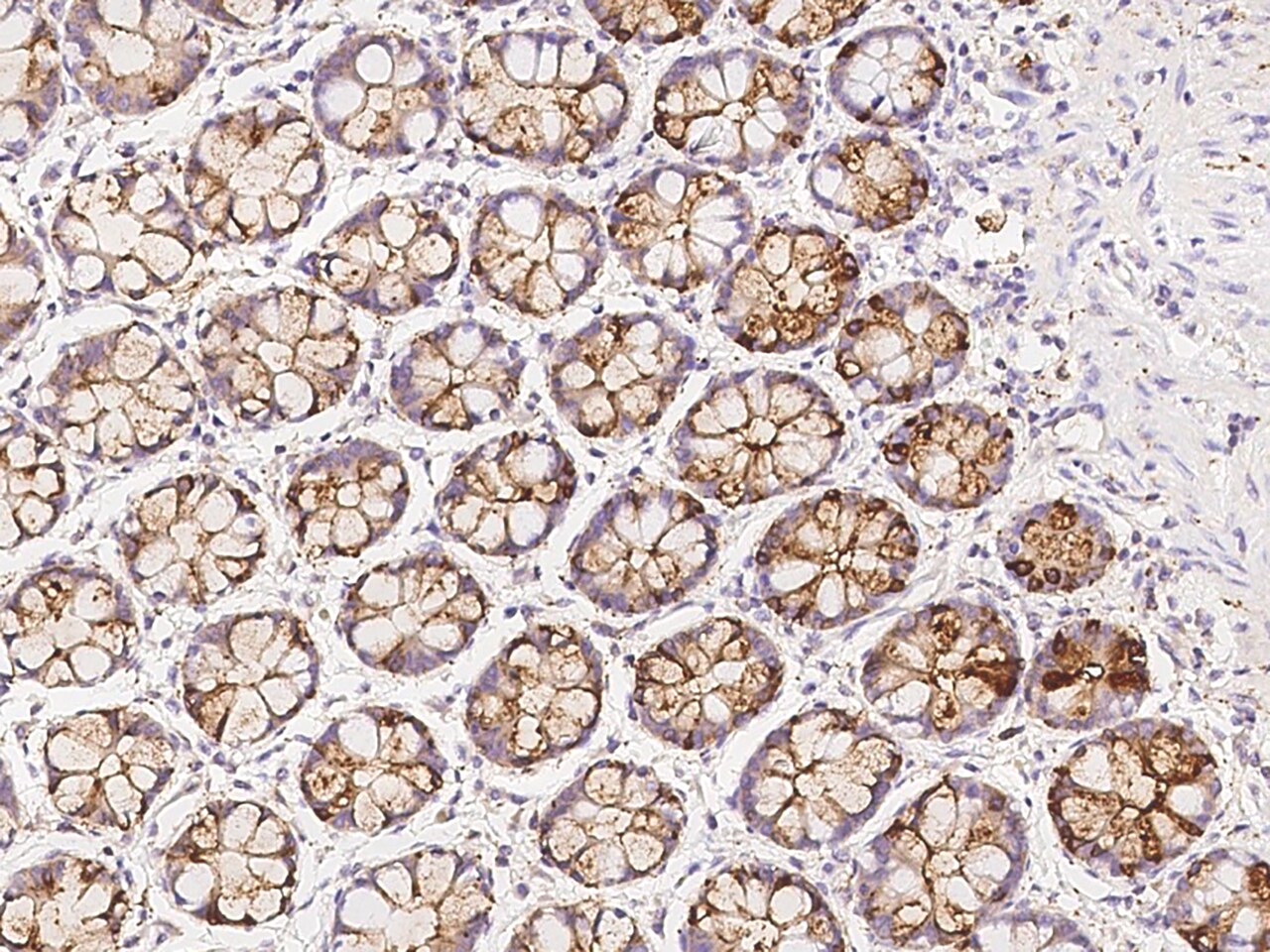 AP1G2 Antibody - BSA Free