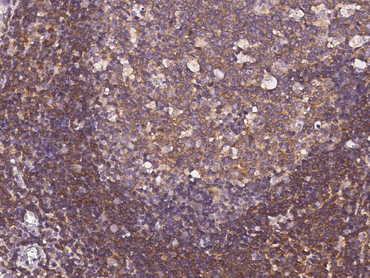 IRE1 alpha Antibody (10B2B2) - Azide and BSA Free