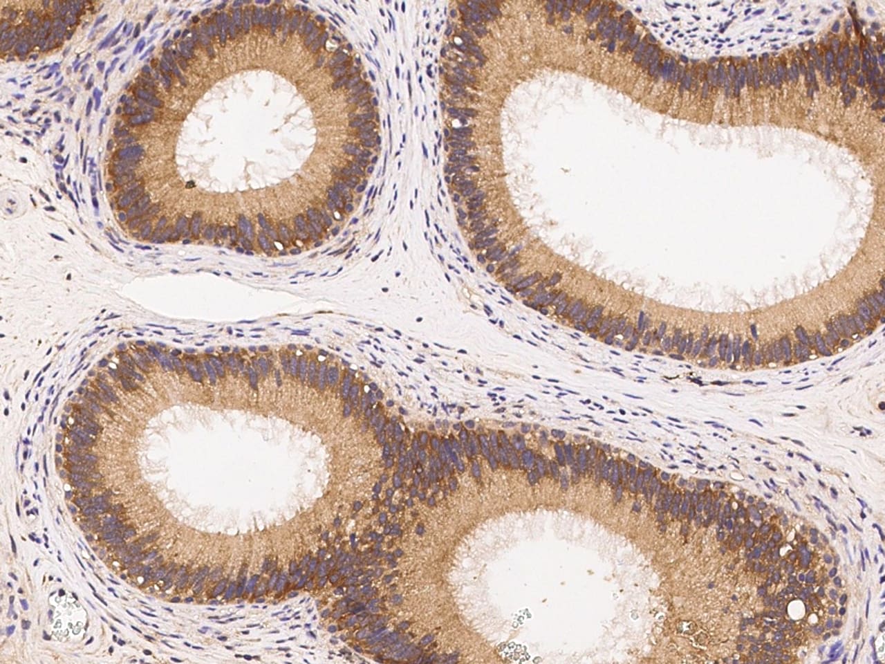 IRE1 alpha Antibody (10B2B2) - Azide and BSA Free