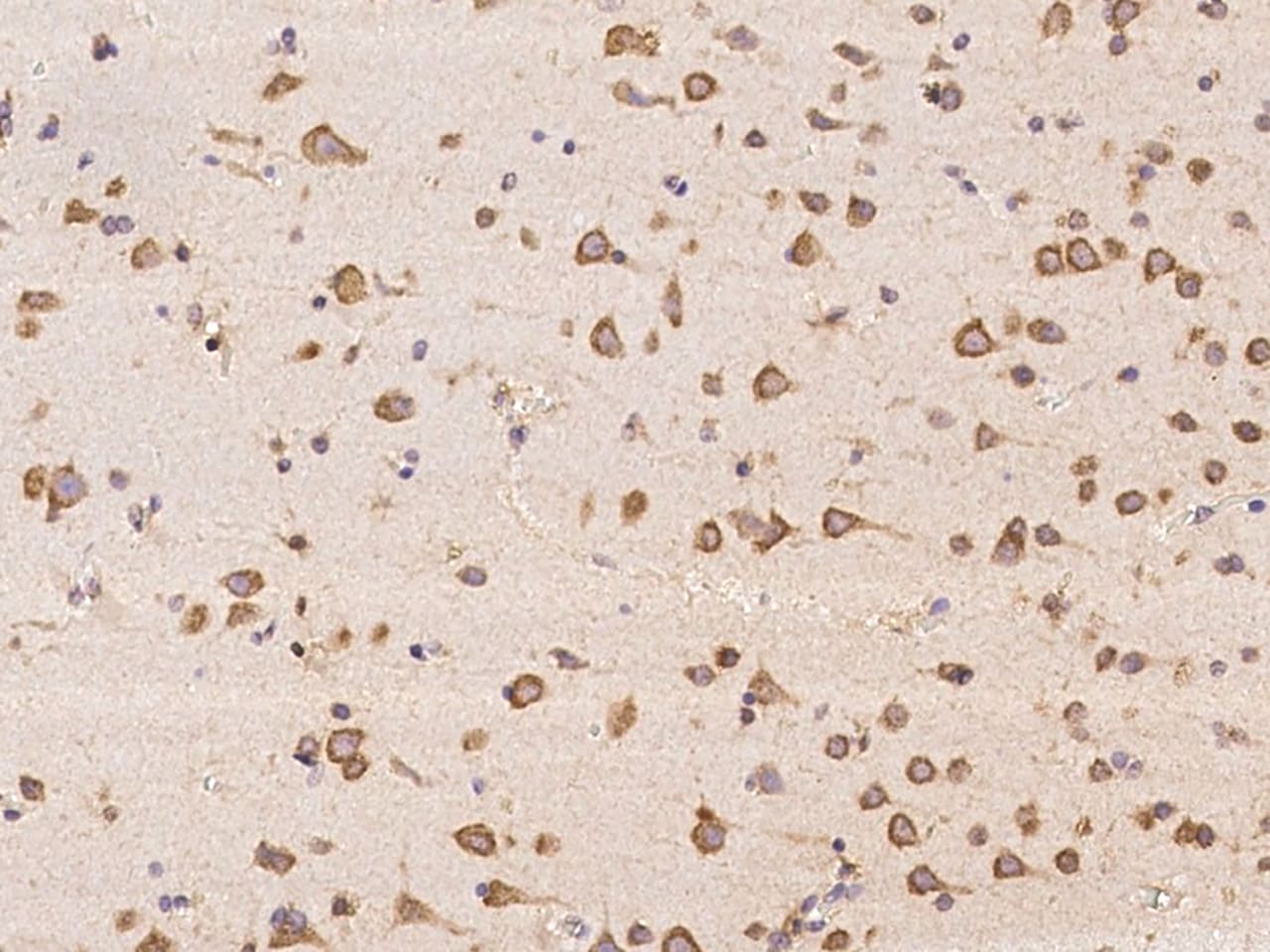 ABCA10 Antibody - BSA Free