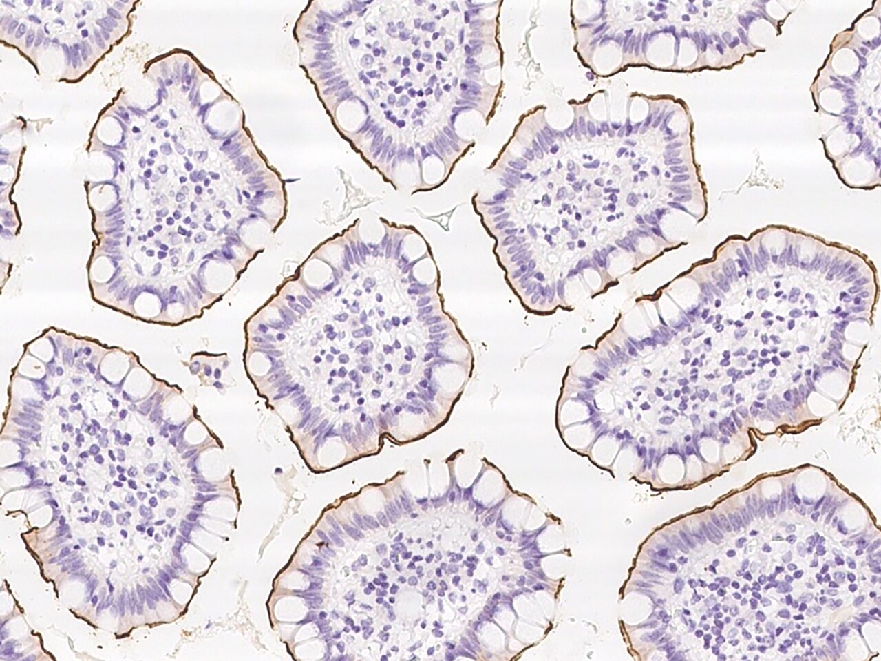 Kv3.3 Antibody - BSA Free