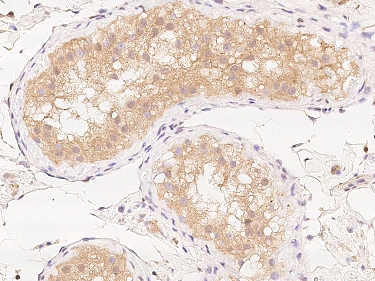 ZNF804B Antibody - BSA Free