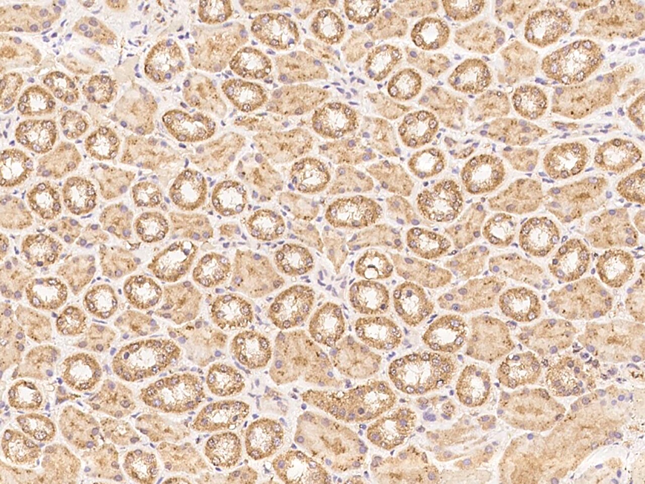 ZNF804B Antibody - BSA Free