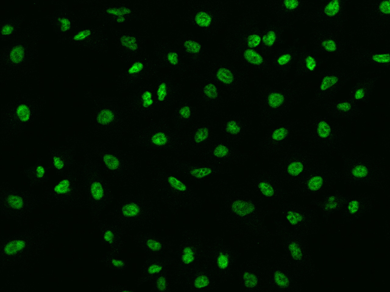 SBNO1 Antibody - BSA Free