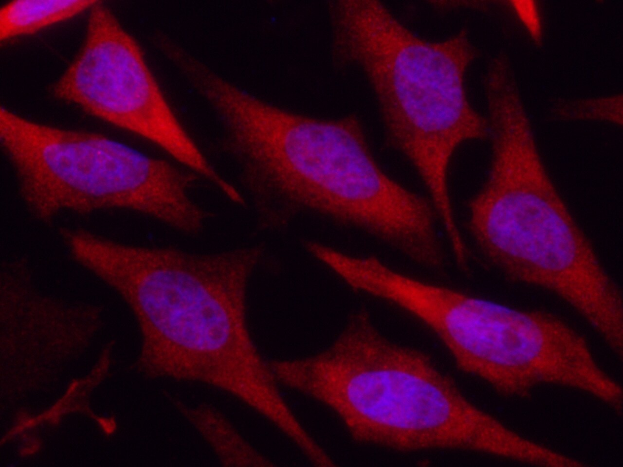 Park7/DJ-1 Antibody (007) - Azide and BSA Free