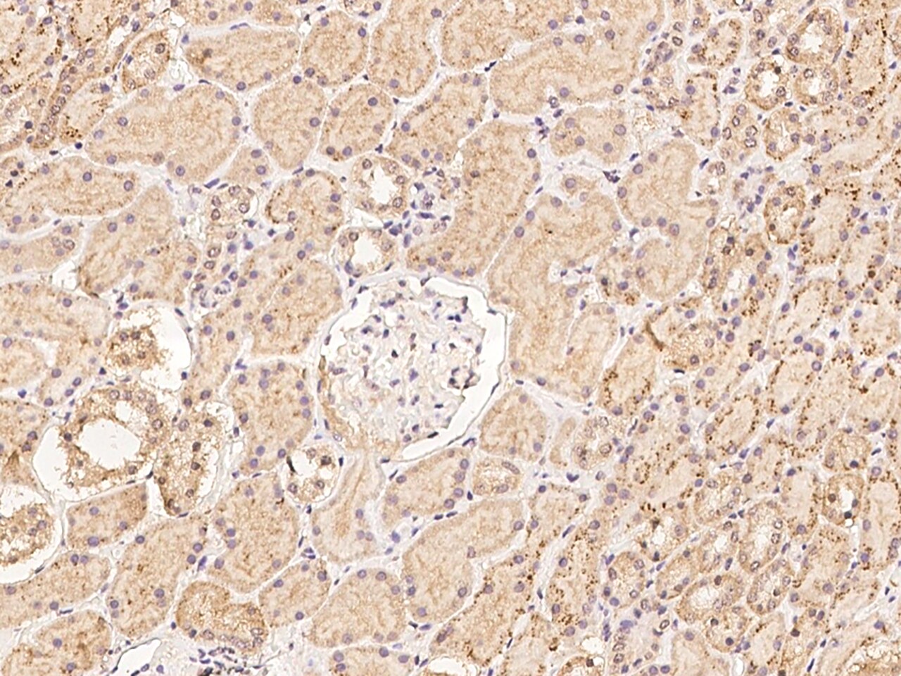 CLN6 Antibody - BSA Free