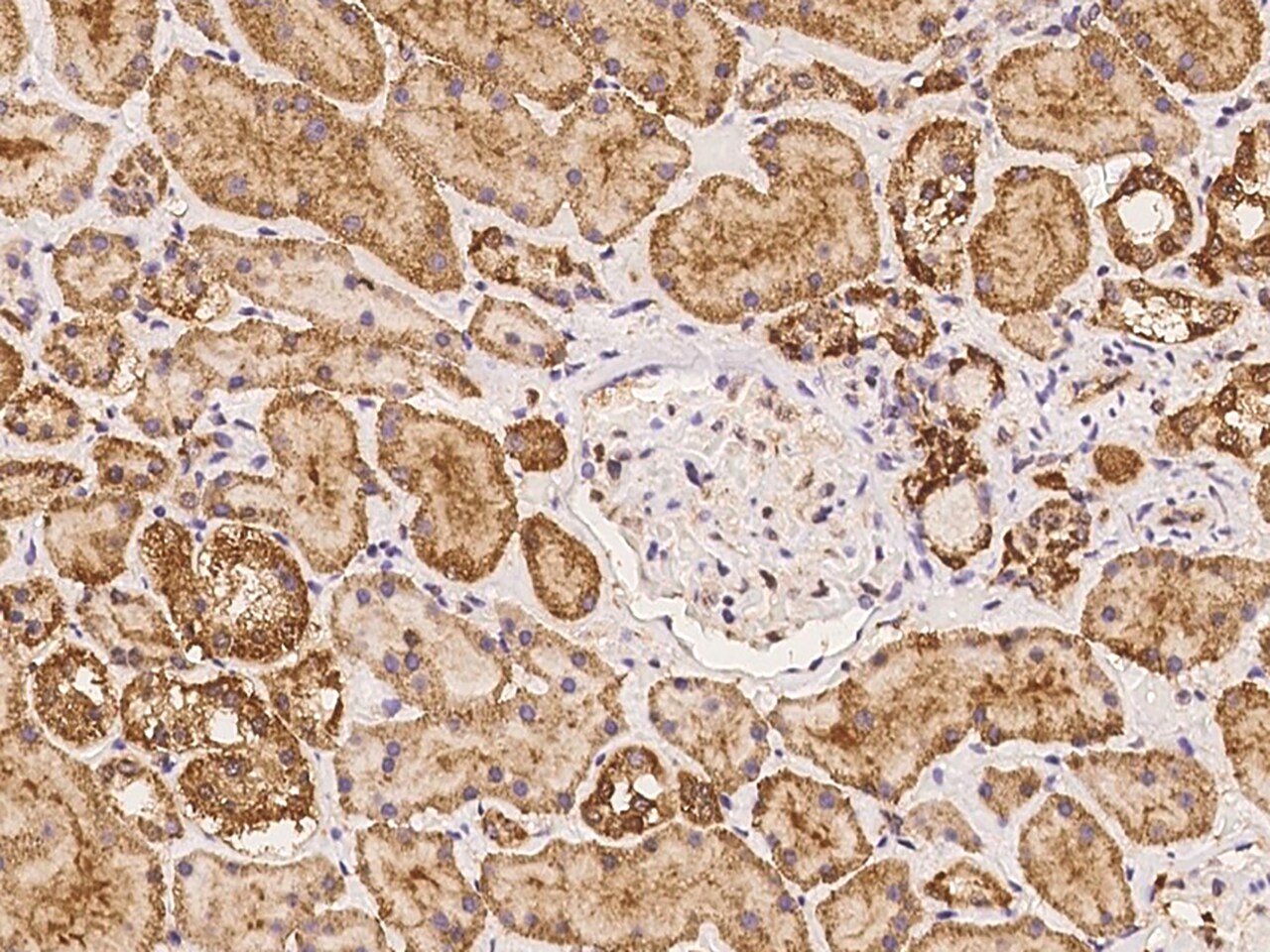 LHFPL2 Antibody - BSA Free