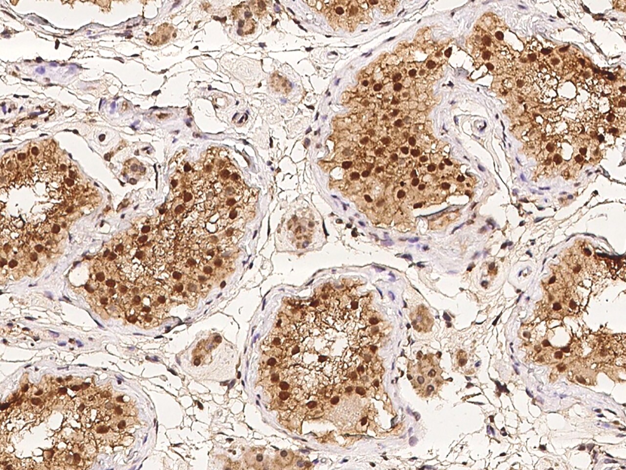 LEMD3 Antibody - BSA Free