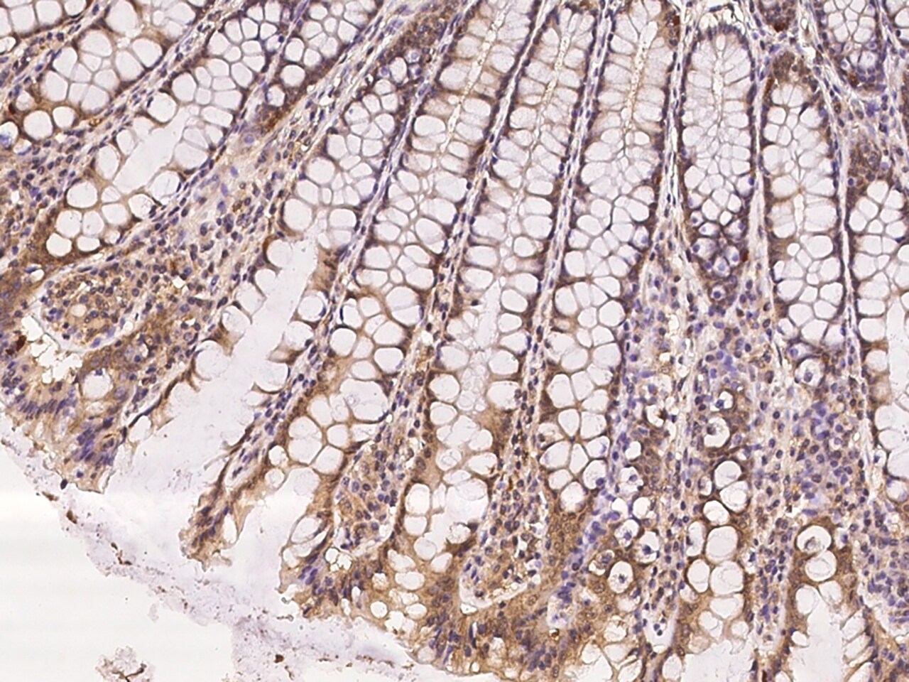 LEMD3 Antibody - BSA Free