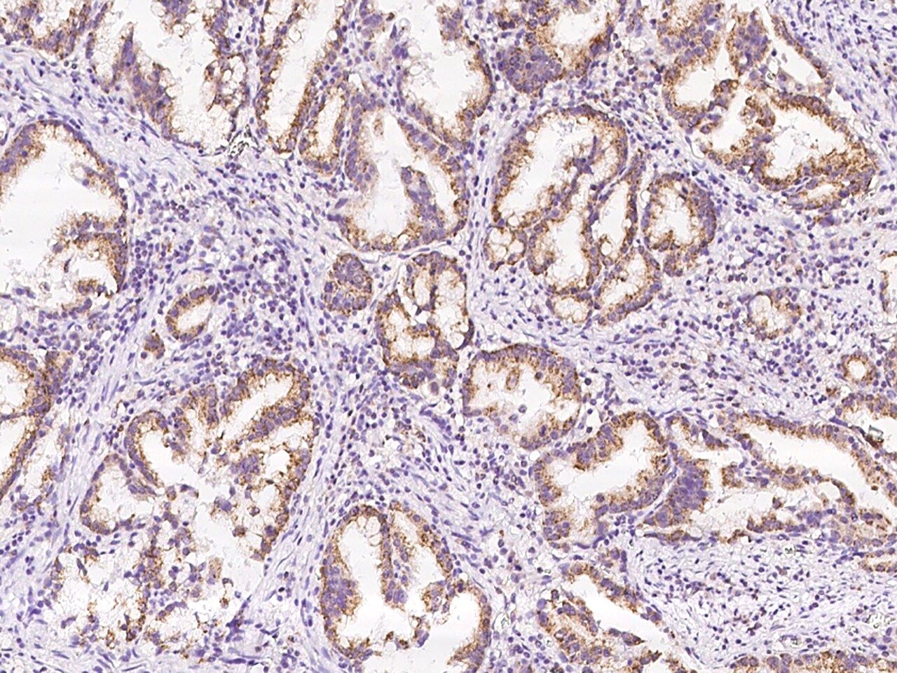 SPRYD5 Antibody - BSA Free