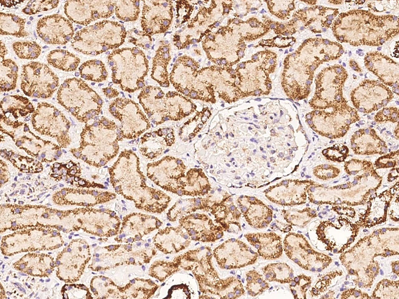 COQ2 Antibody - BSA Free