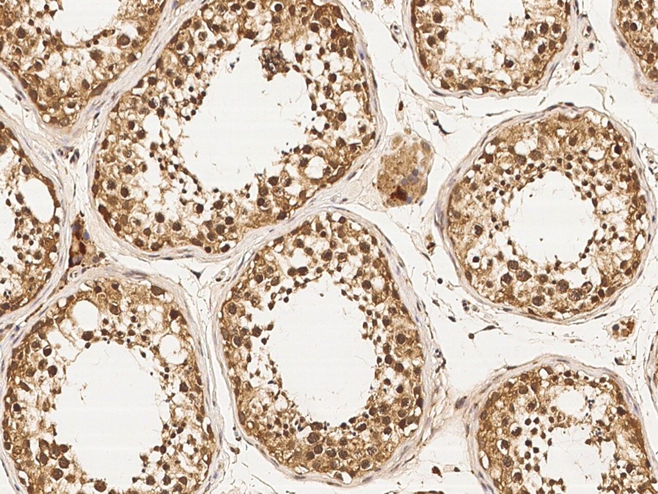 DZIP1 Antibody (05) - Azide and BSA Free