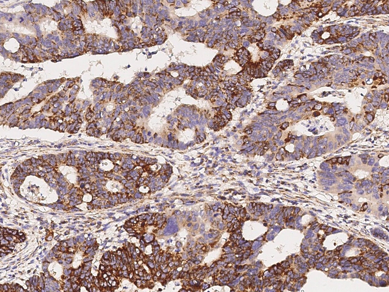 COX4-I1 Antibody - Azide and BSA Free