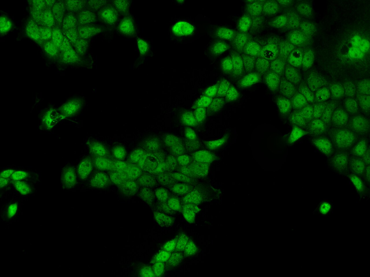 CCDC141 Antibody - BSA Free