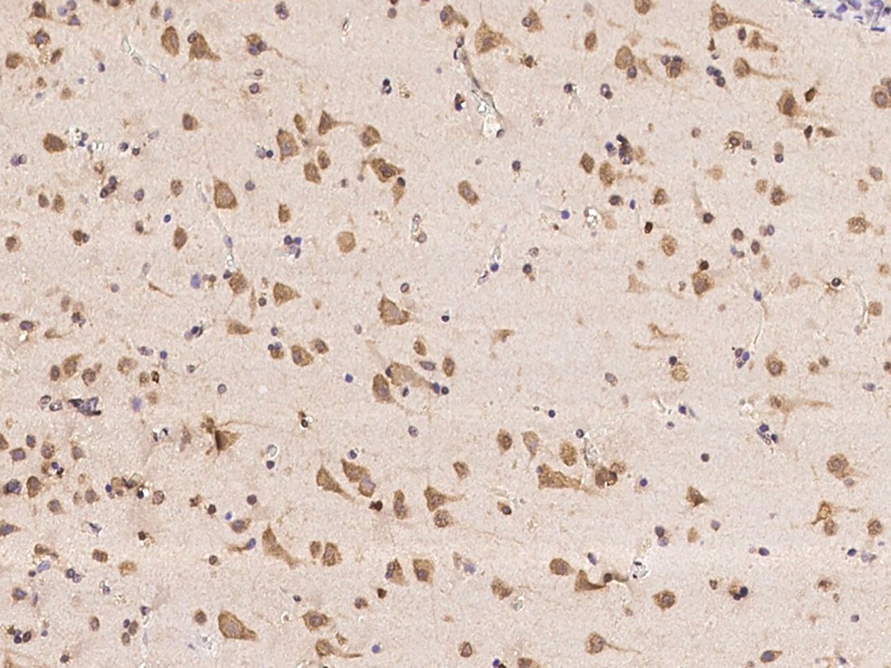 Huntingtin Interacting Protein K Antibody - BSA Free