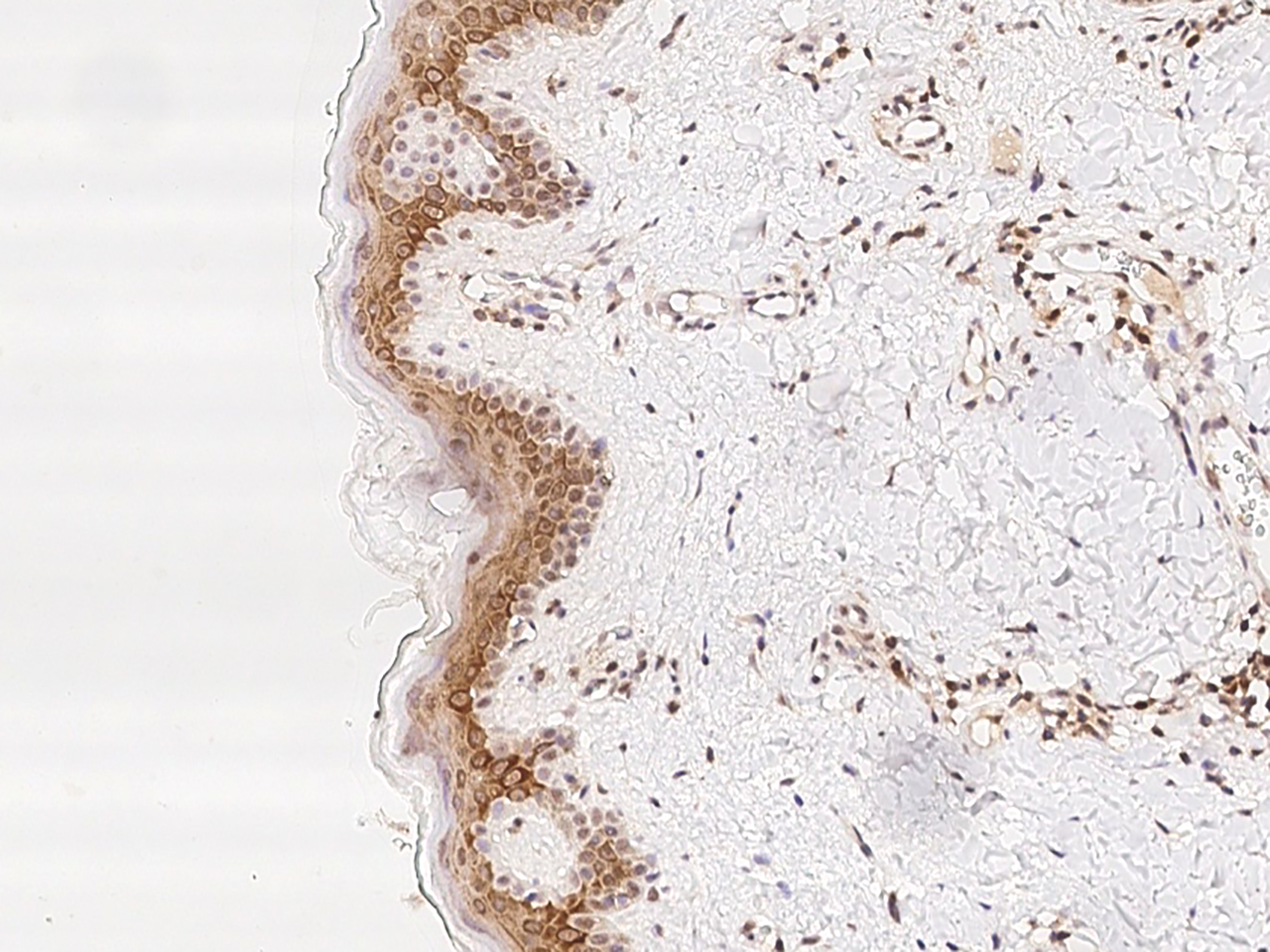 TMC2 Antibody - BSA Free