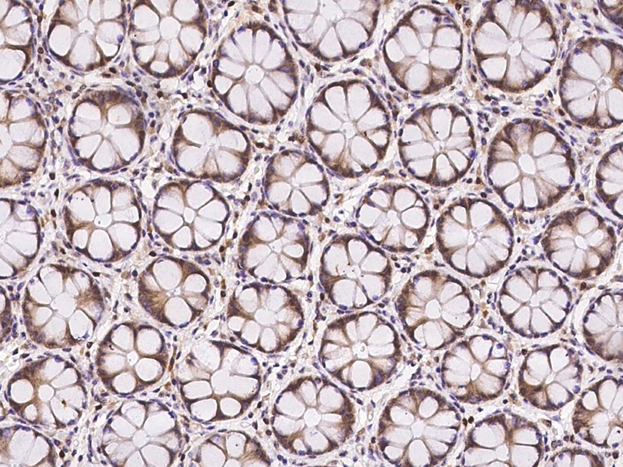 TMC2 Antibody - BSA Free