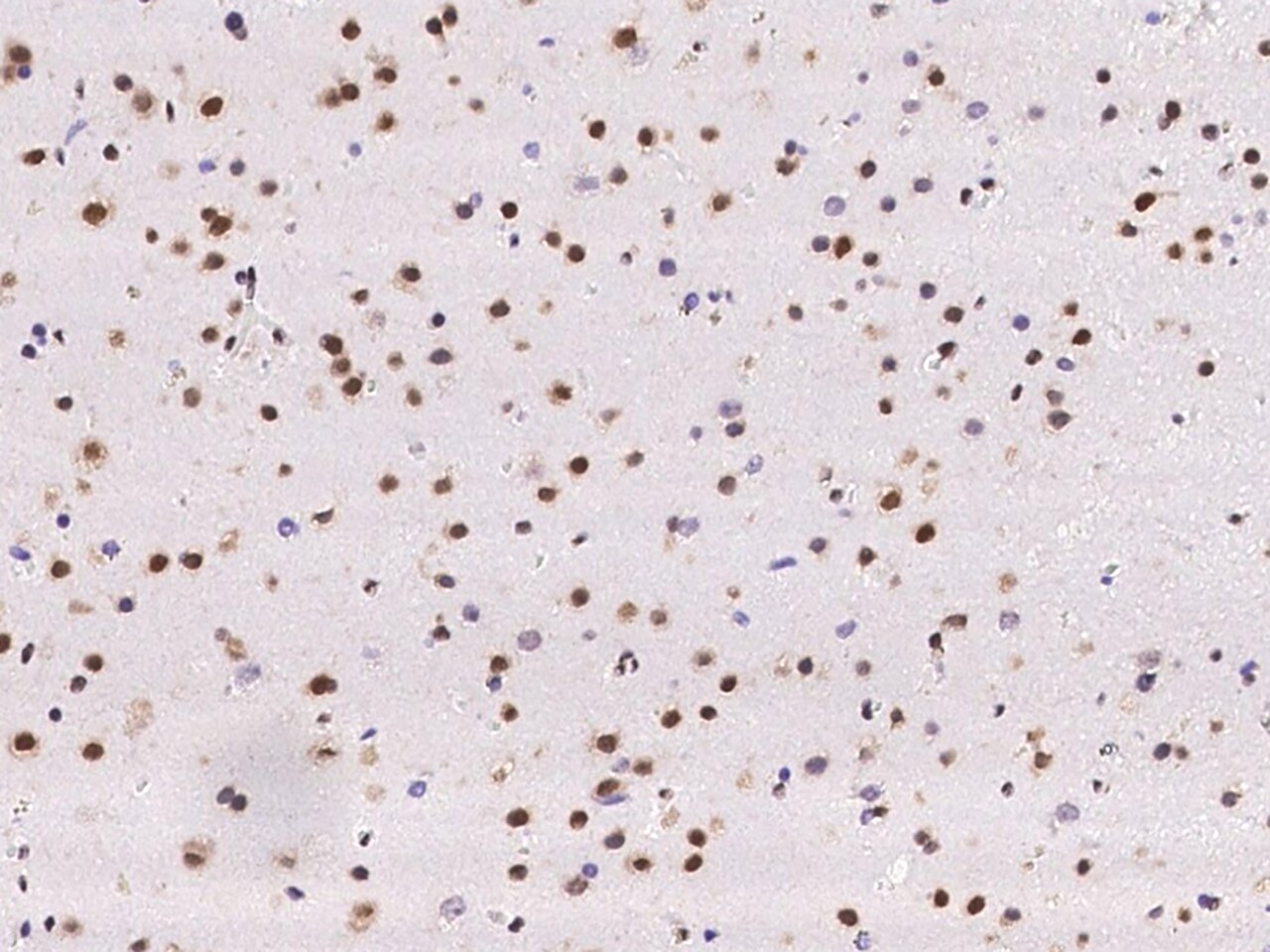 SCAF8/RBM16 Antibody - BSA Free