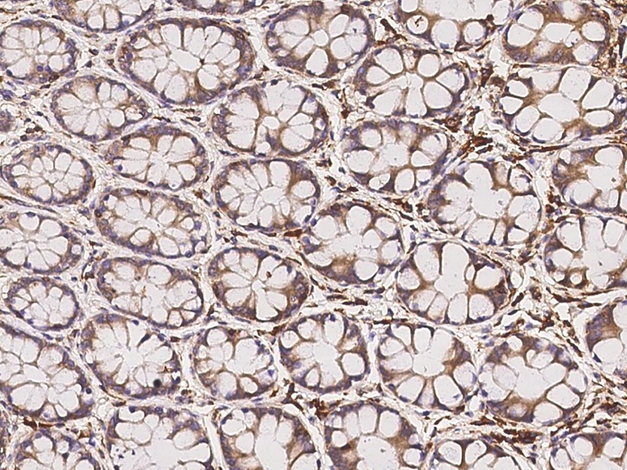 FAM188B Antibody - BSA Free