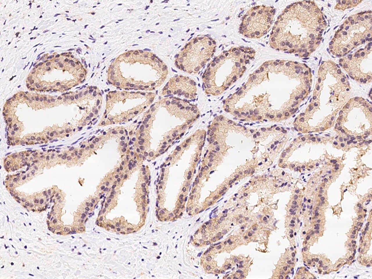 CBWD1 Antibody - BSA Free
