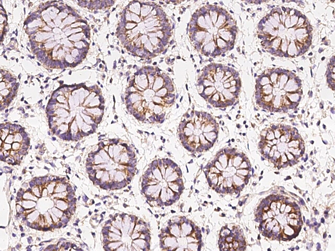 CCDC66 Antibody - BSA Free