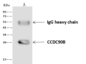 CCDC90B Antibody - BSA Free