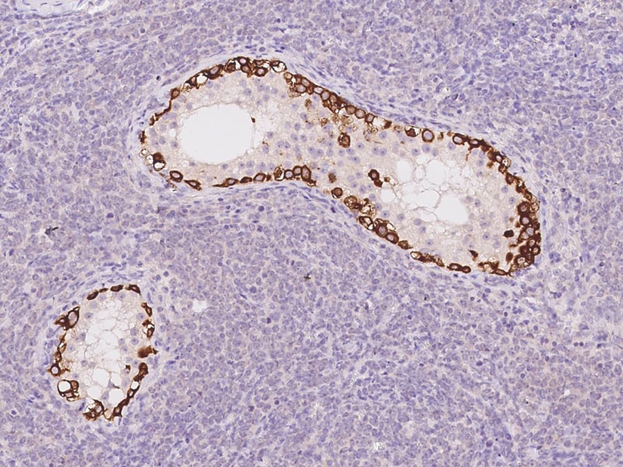 STK31 Antibody - BSA Free