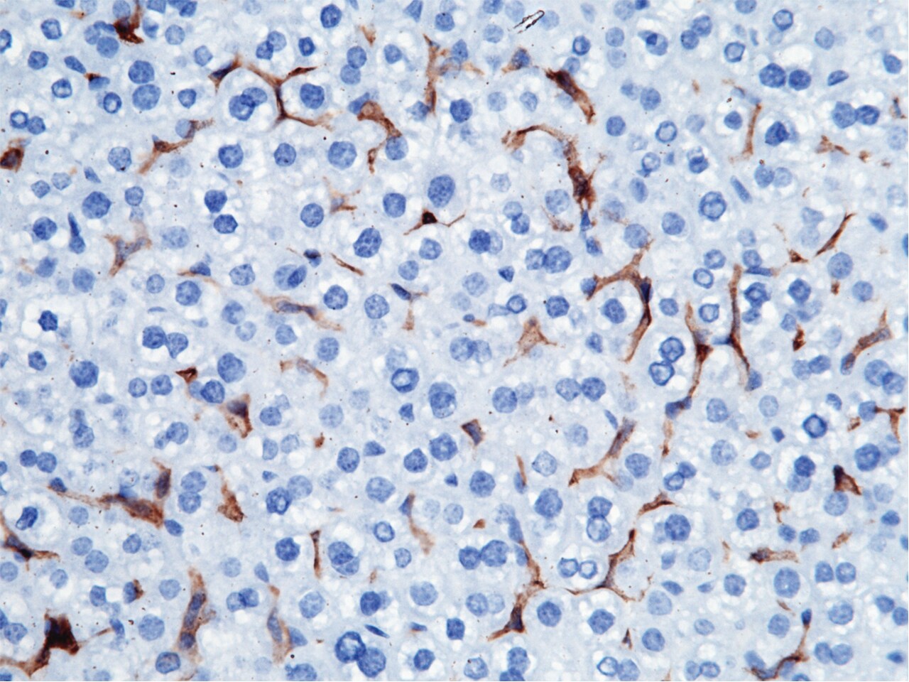 FcgR4/CD16-2 Antibody (011) - Azide and BSA Free