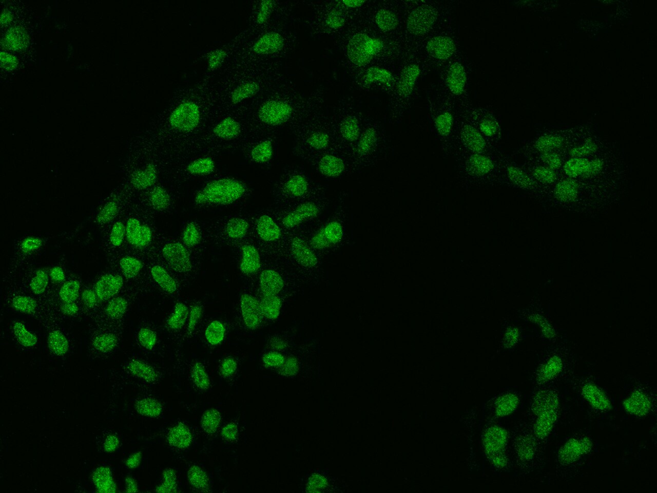 ZKSCAN2 Antibody - BSA Free