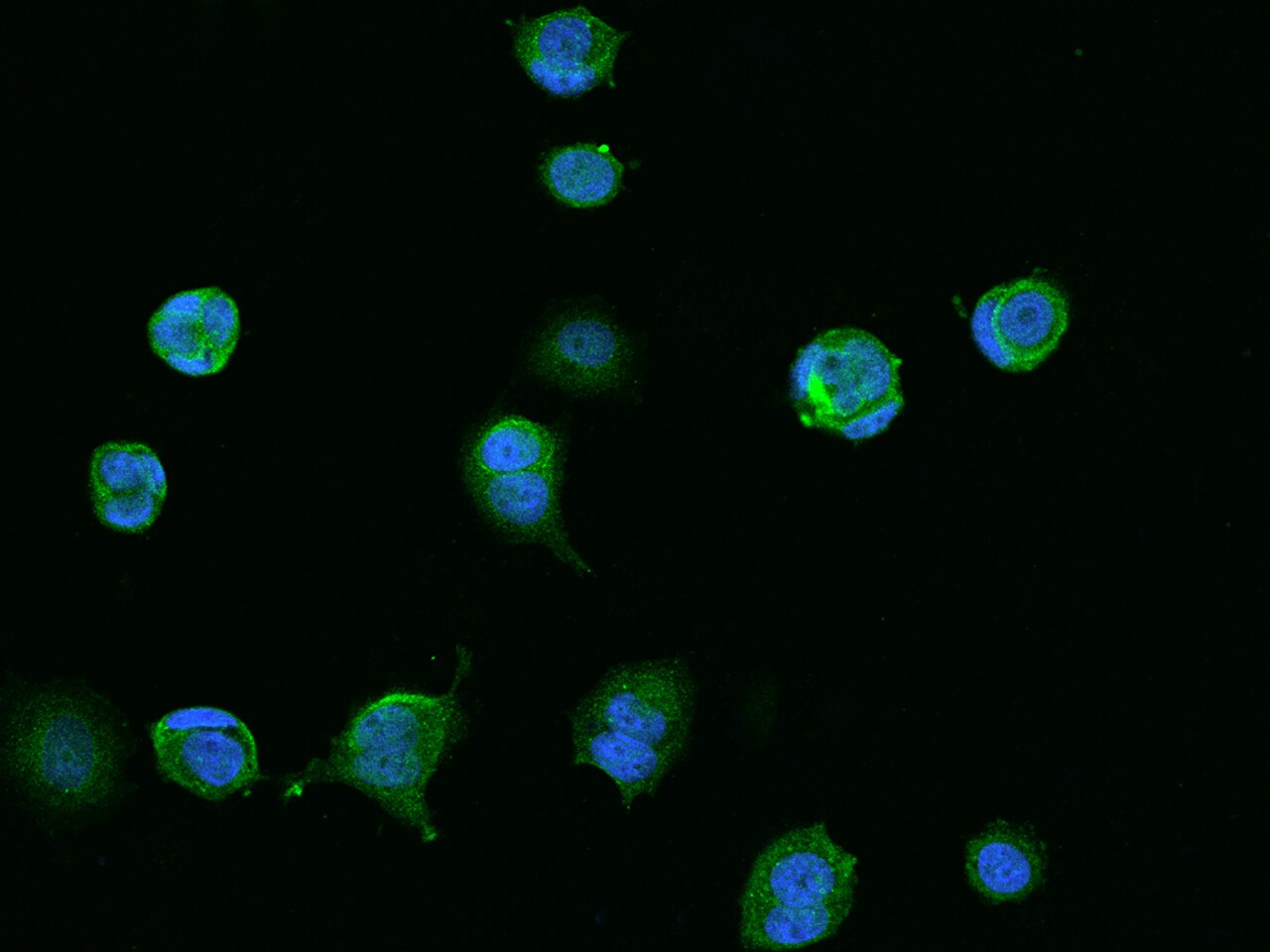 CCDC9 Antibody - BSA Free