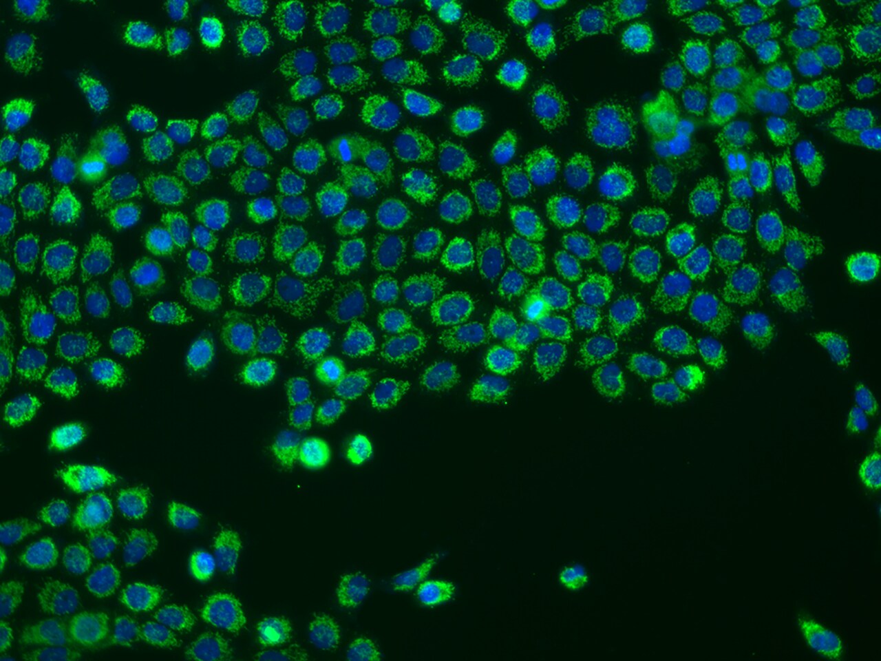 CHCHD10 Antibody - BSA Free