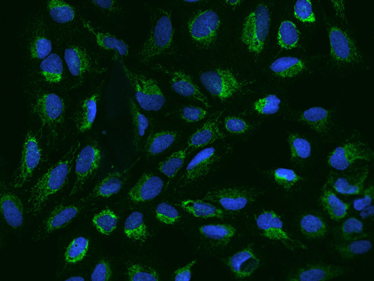 CHCHD5 Antibody - BSA Free