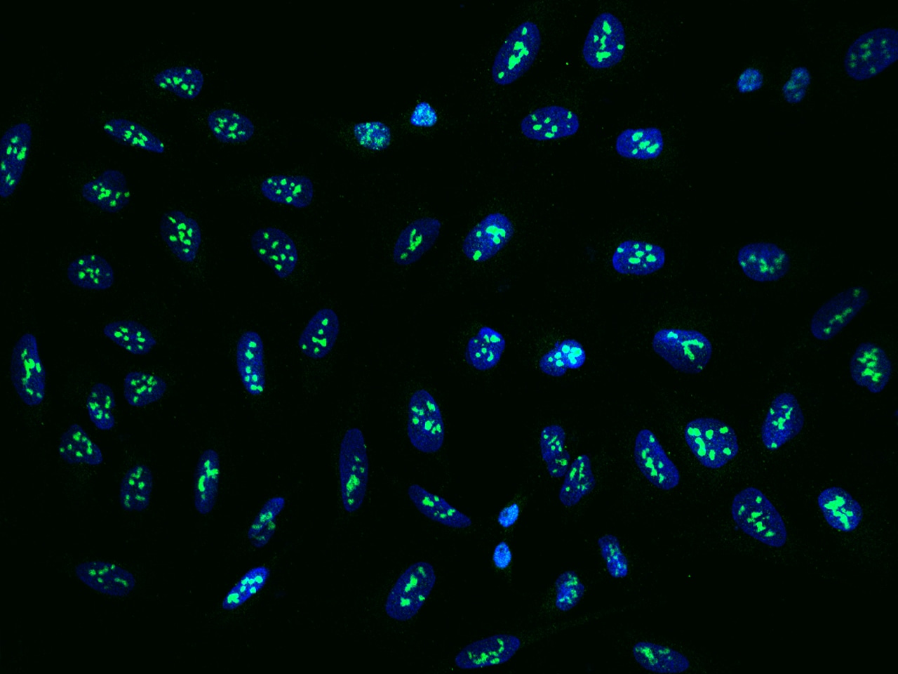 FTSJ3 Antibody - BSA Free