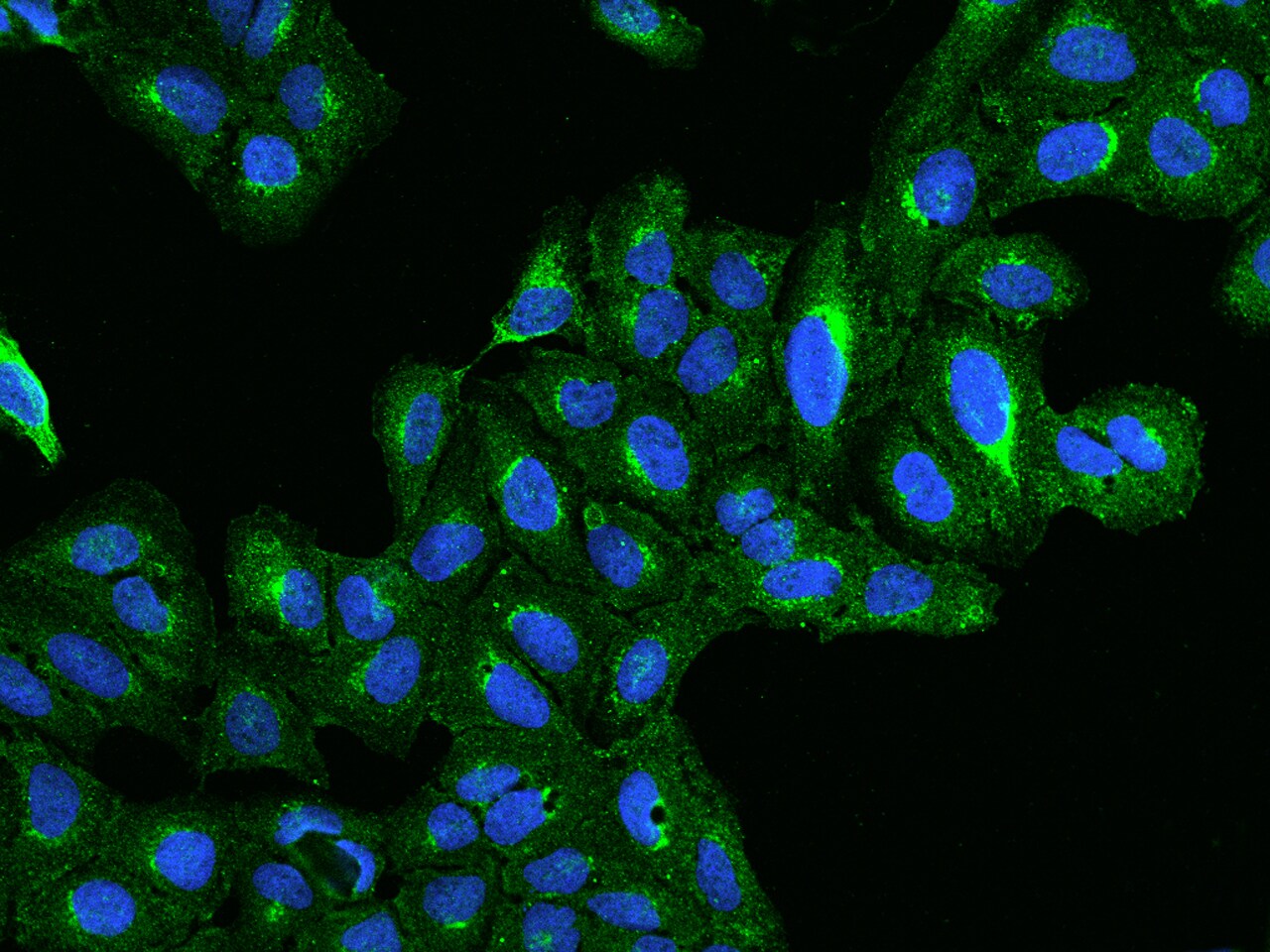 BET1L Antibody - BSA Free