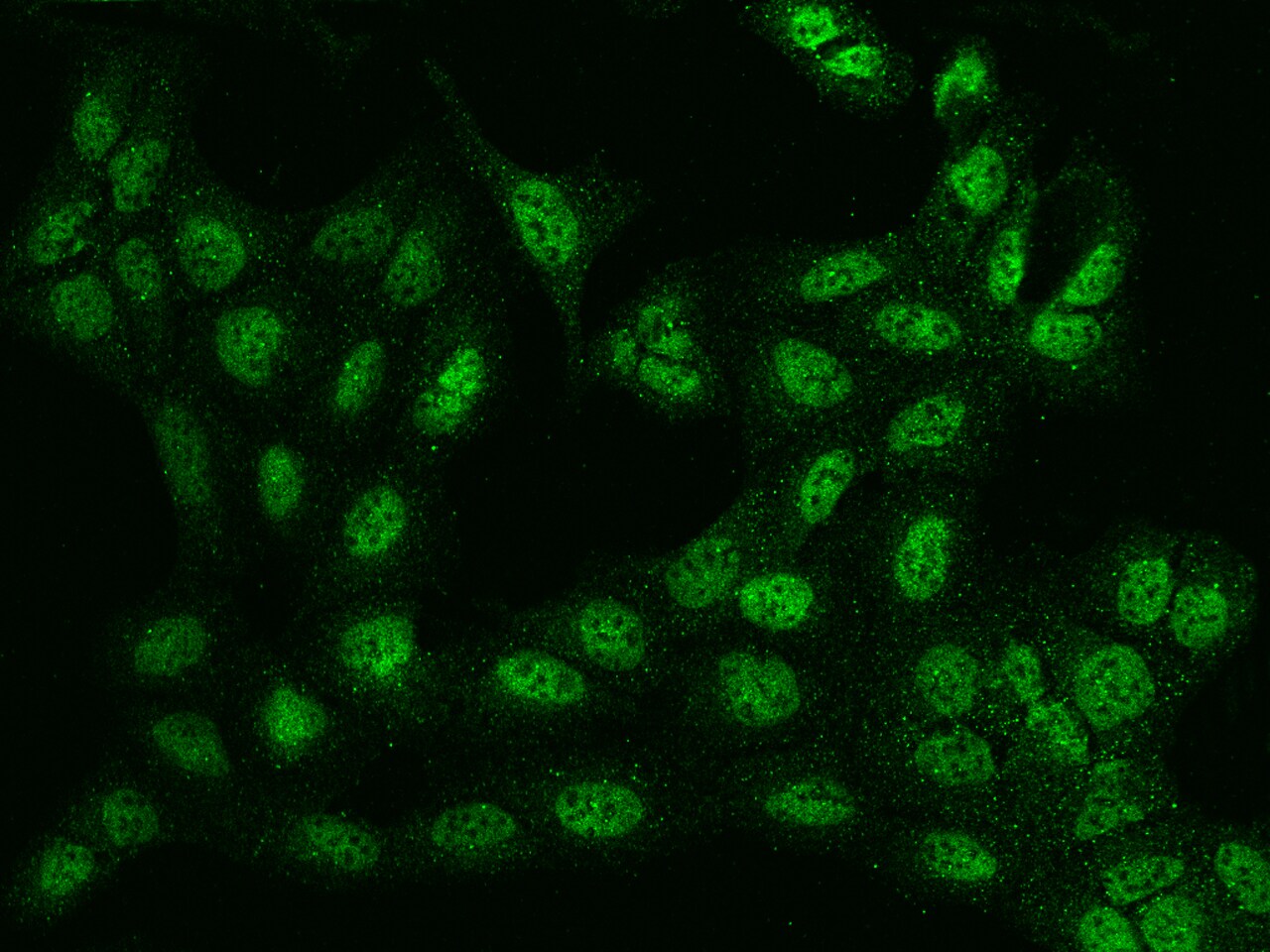 BTBD9 Antibody - BSA Free