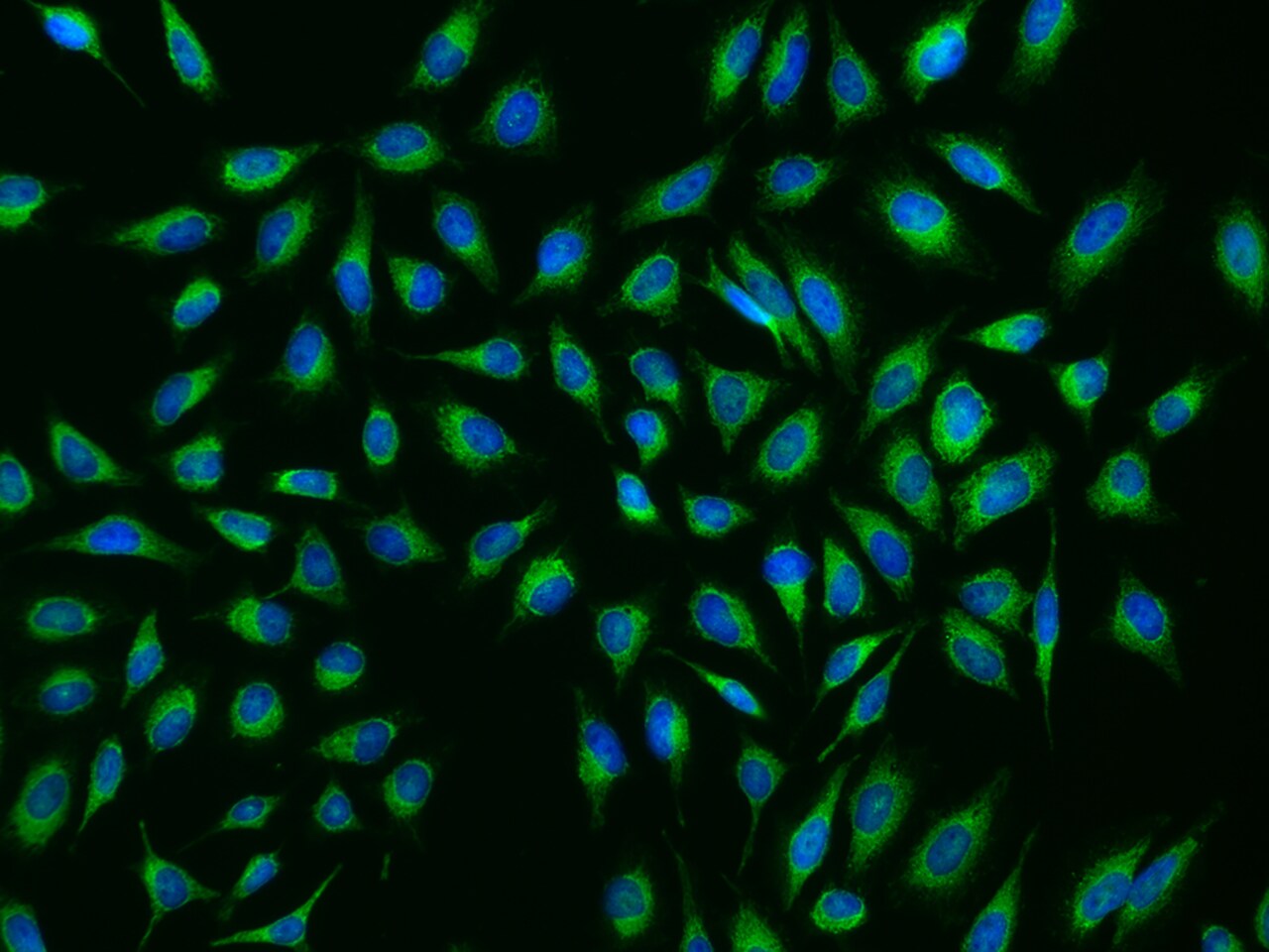 NDUFB8 Antibody - BSA Free