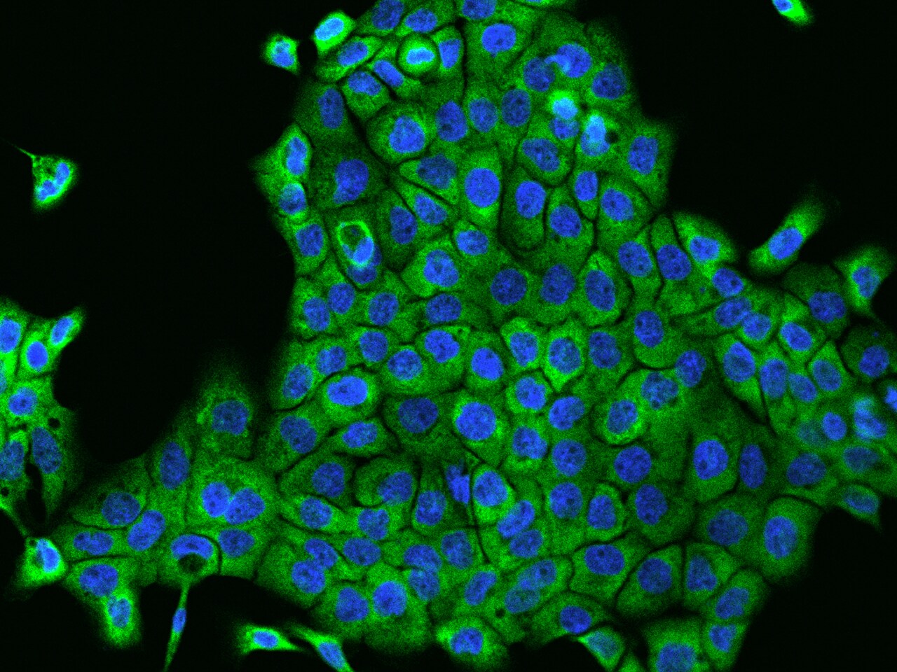 VARS Antibody - BSA Free