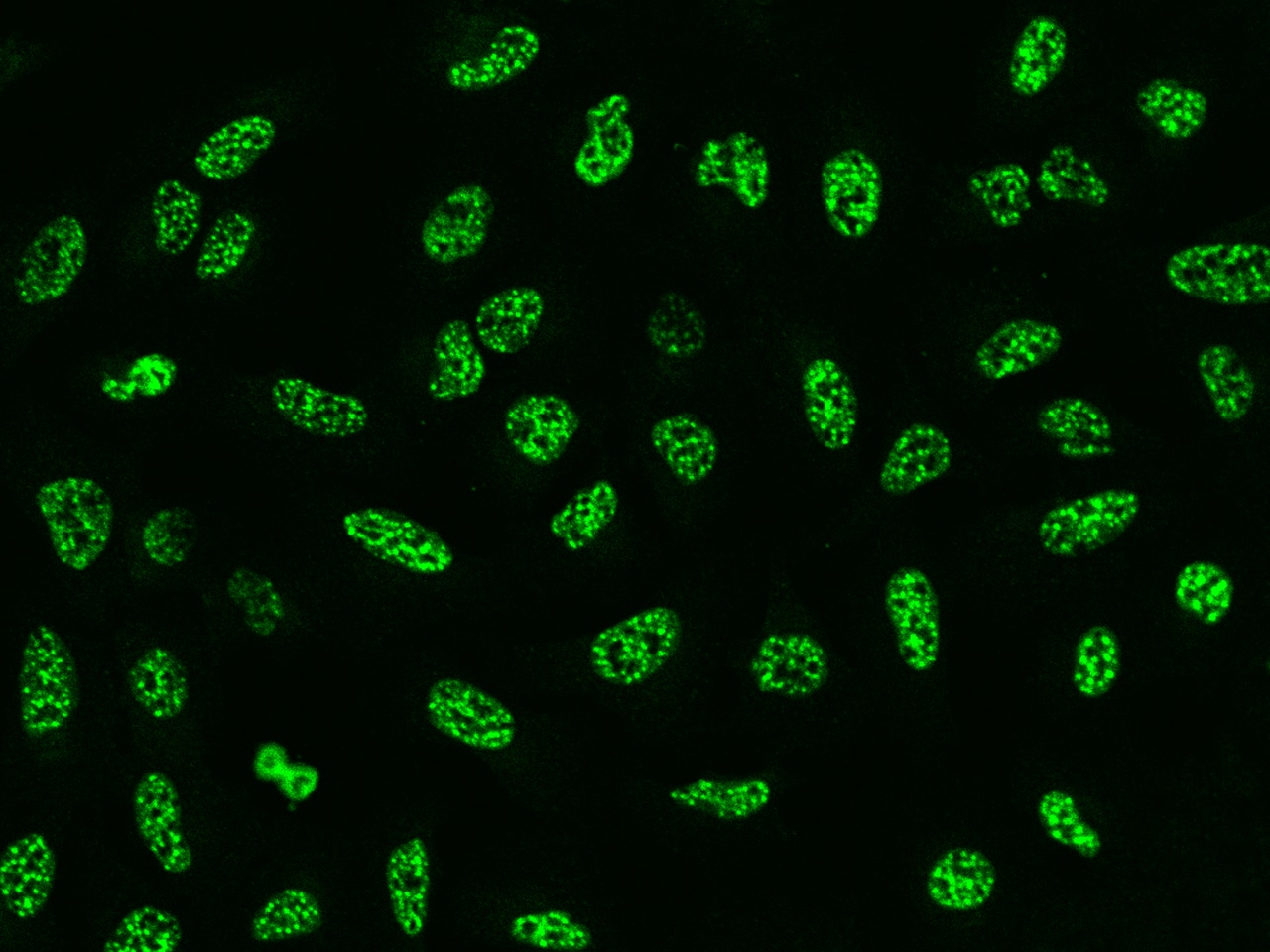 SRRM2 Antibody - BSA Free