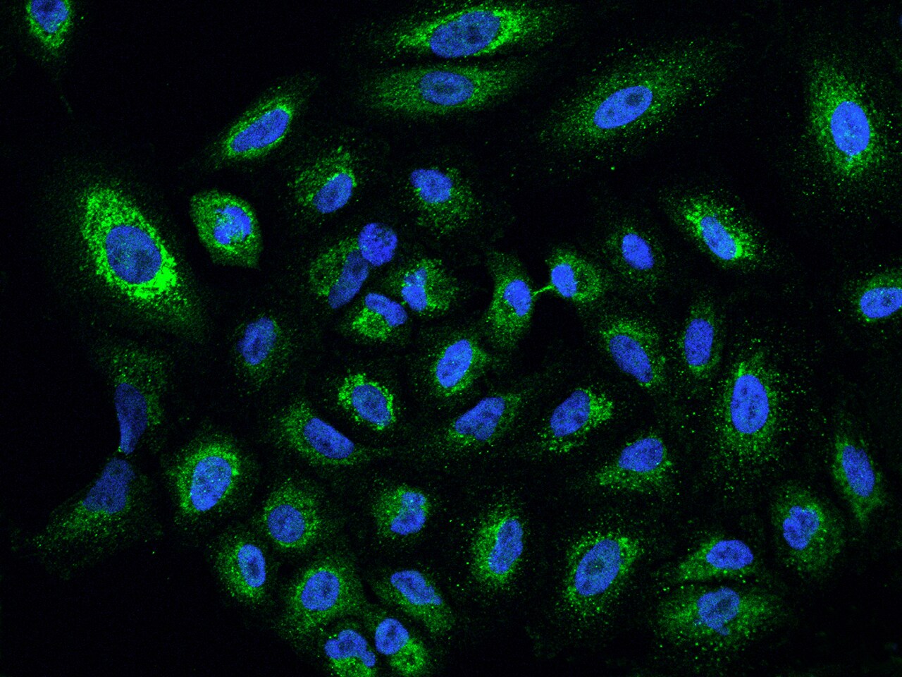 CYP24A1 Antibody - BSA Free