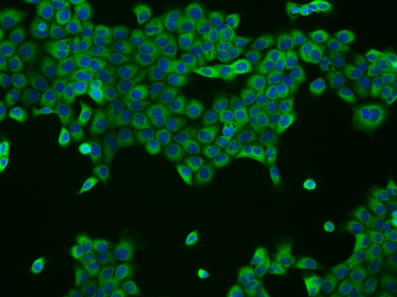 UBXD2 Antibody - BSA Free