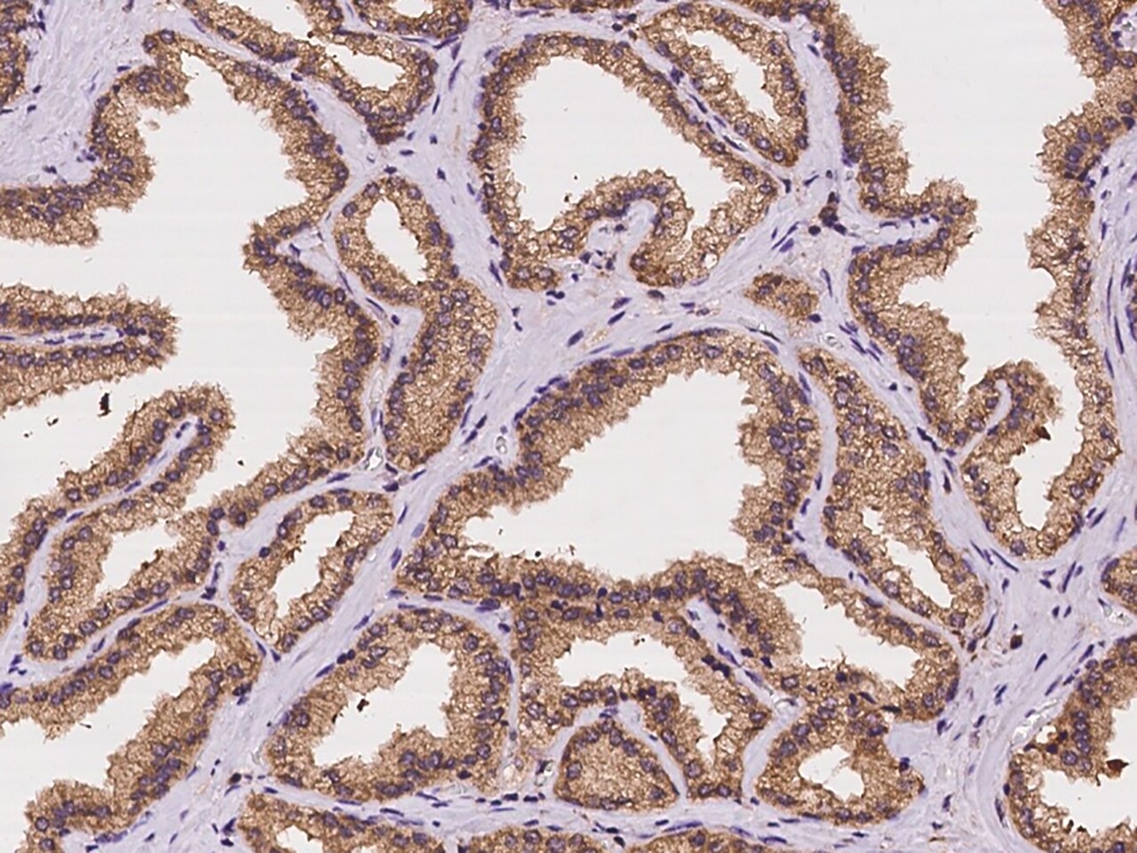 STX17 Antibody - BSA Free
