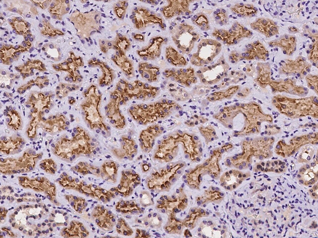 GPR63 Antibody - BSA Free