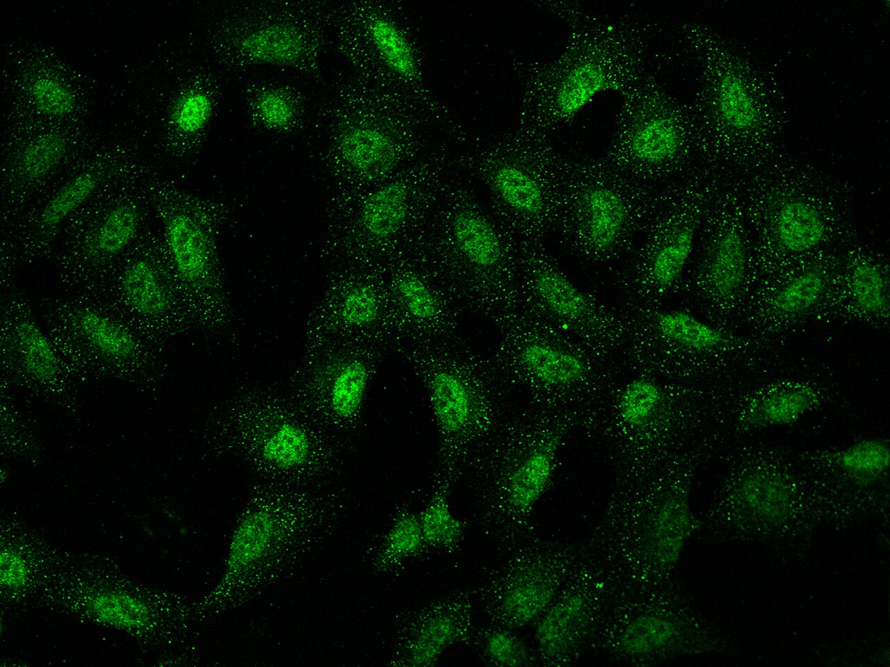 NUP188 Antibody - BSA Free