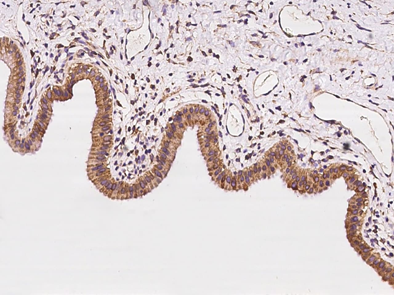 CLCC1 Antibody - BSA Free