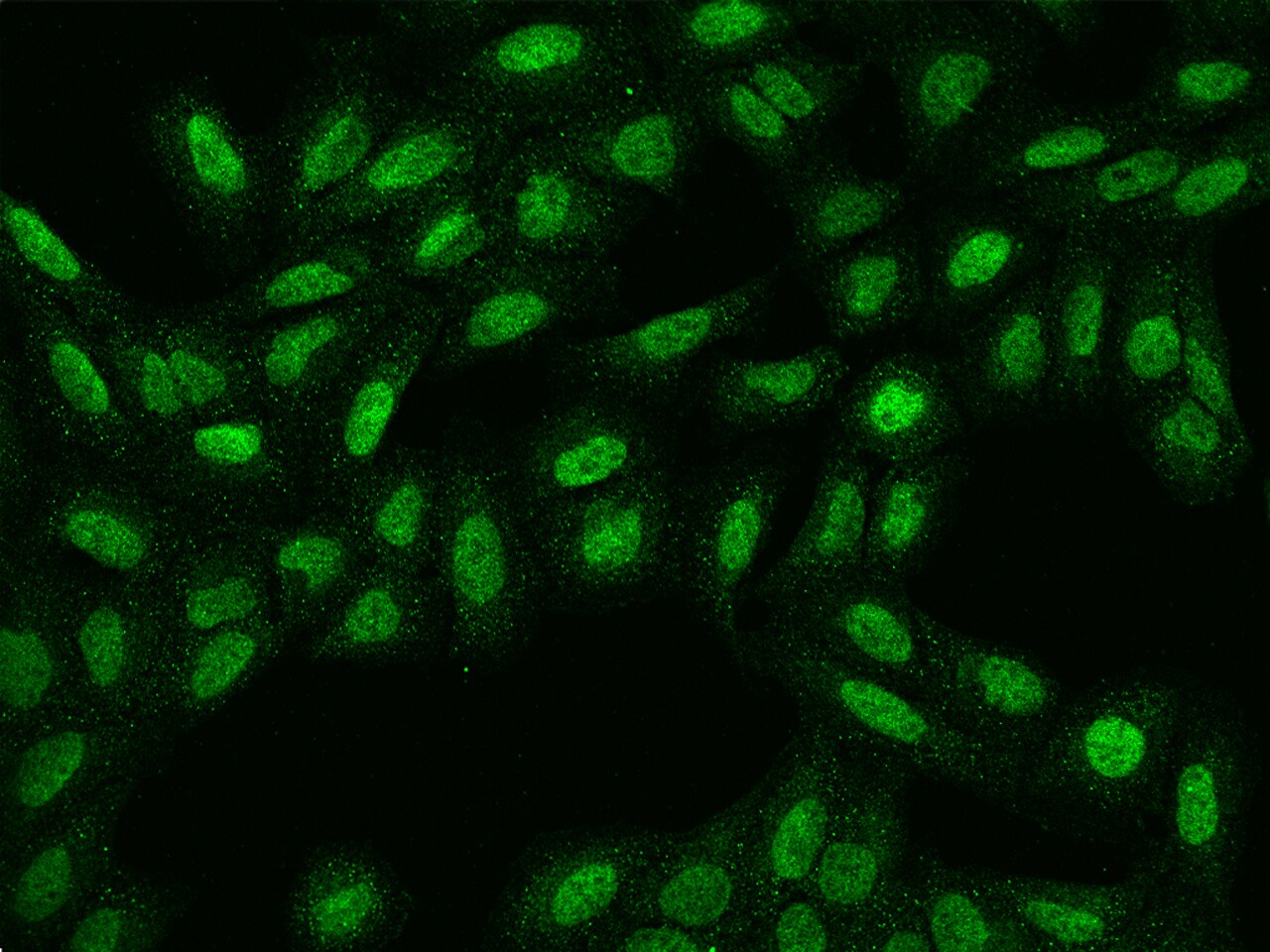 SPATA31E1 Antibody - BSA Free