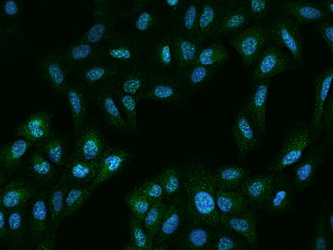 AGTPBP1 Antibody - BSA Free